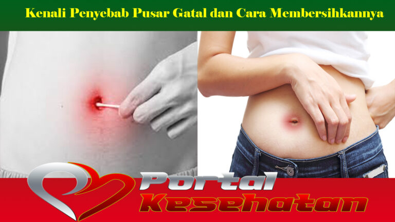 Kenali Penyebab Pusar Gatal dan Cara Membersihkannya