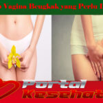 Penyebab Vagina Bengkak yang Perlu Diketahui