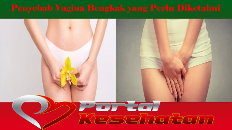 Penyebab Vagina Bengkak yang Perlu Diketahui